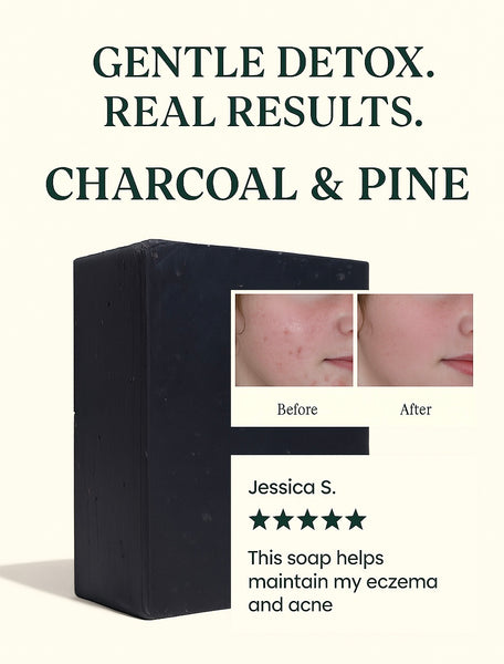 Charcoal & Pine Tar Detox Bar – For Acne & Eczema