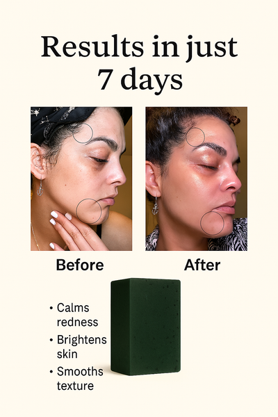 Chlorophyll + Glycolic Acid Soap for Redness & Glow
