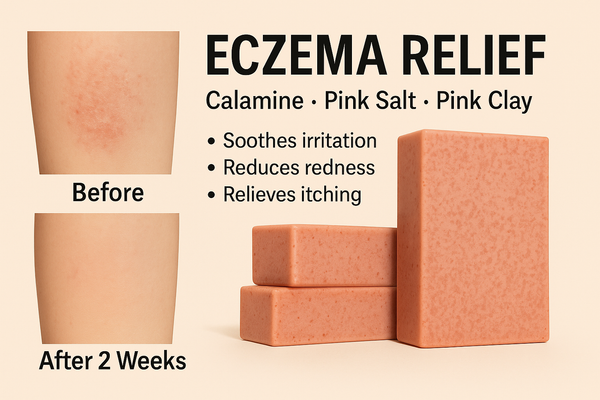 Soothing Calamine Cleanser for Itchy, Sensitive Skin