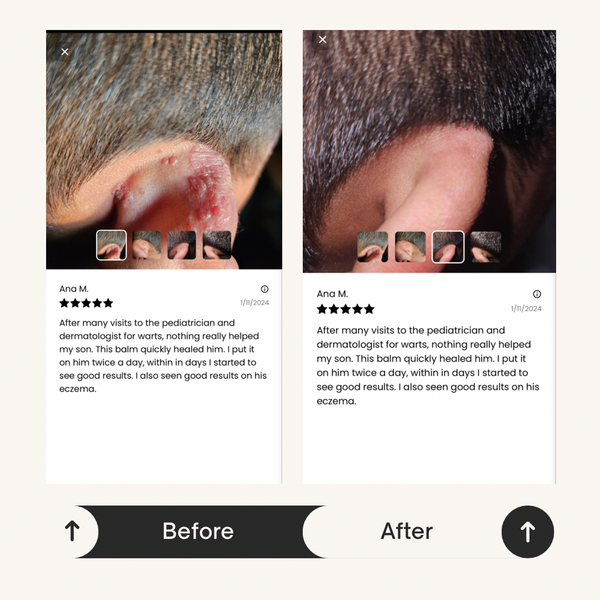 Tick Tock Healing Balm – The Viral Skin Savior